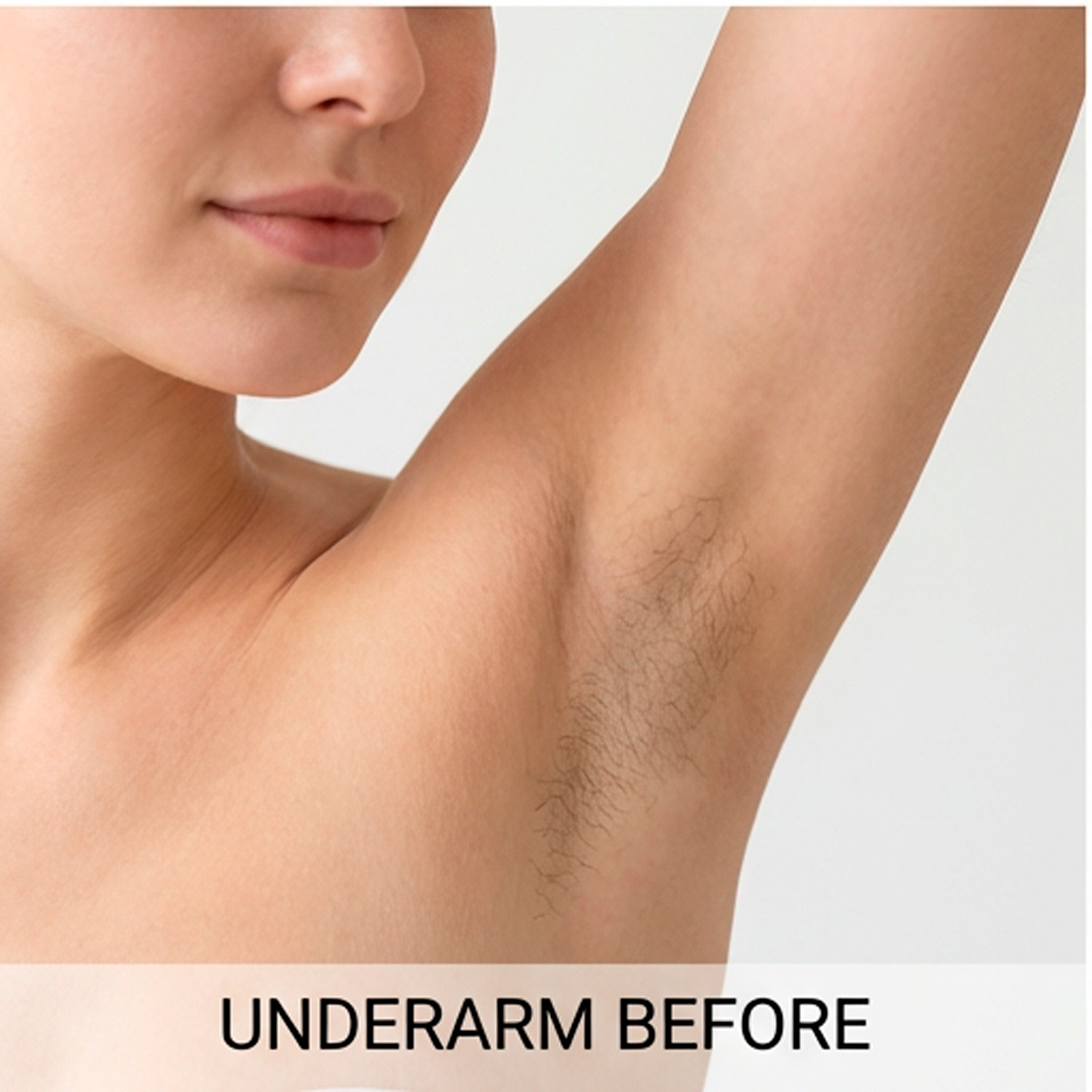 Депиляция 3